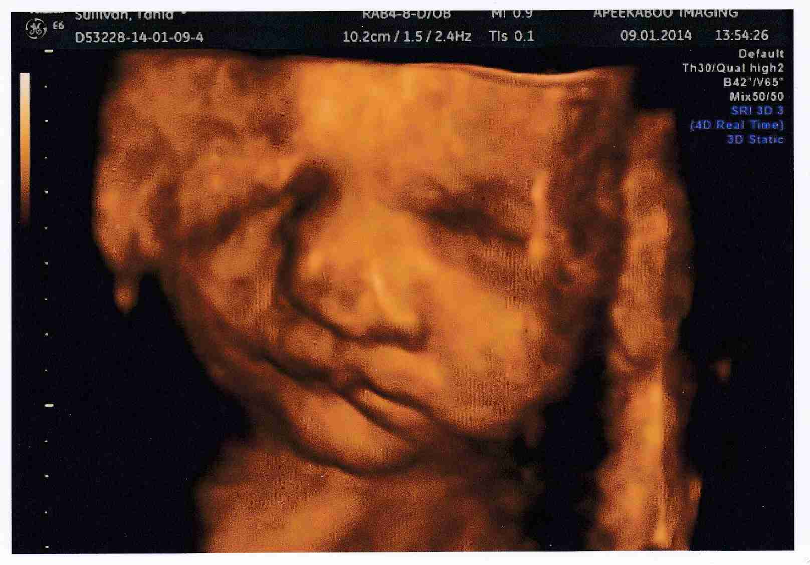 4d baby scan