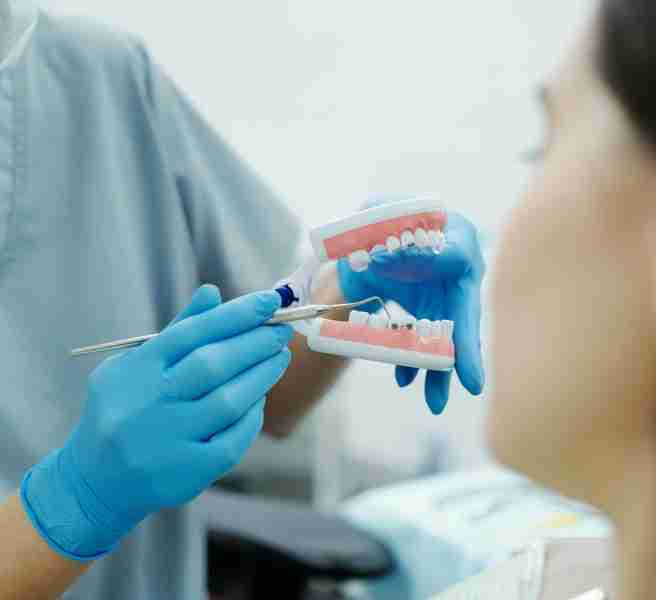braces for adults