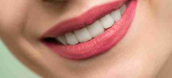 perfect smile