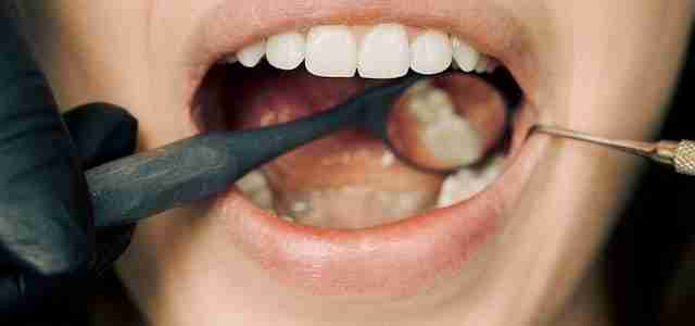 oral health