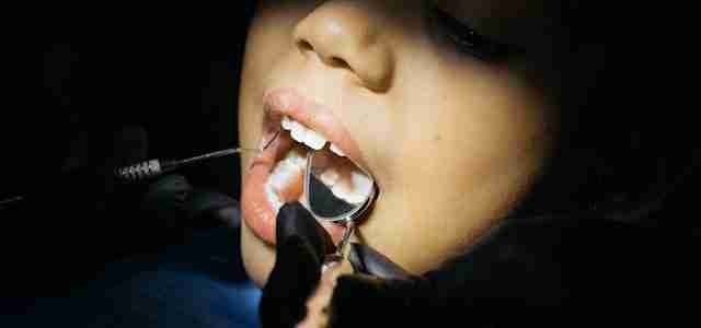 child teeth dentist