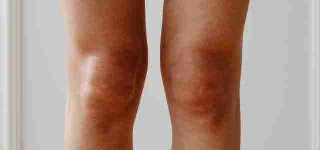 knee joint health